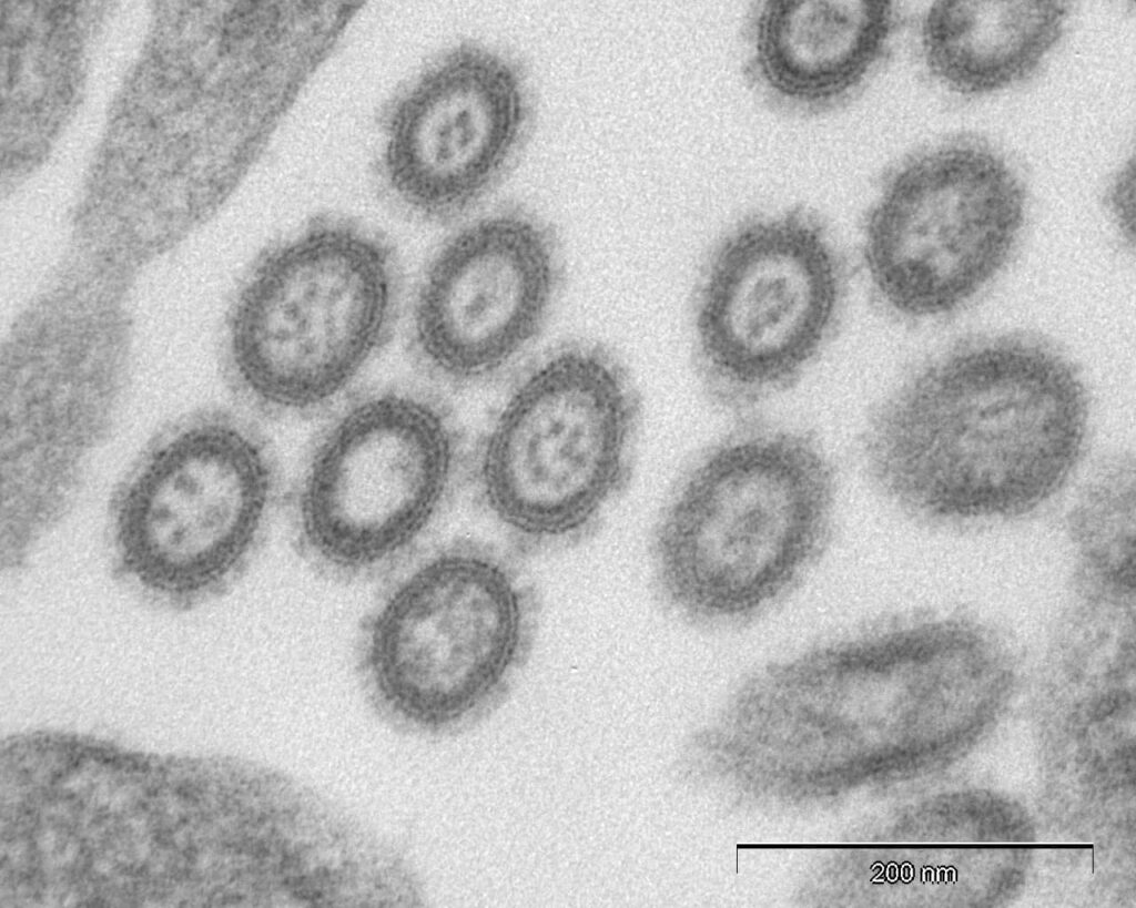 Image au microscope de la grippe H5N1 